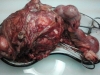 fetus-2